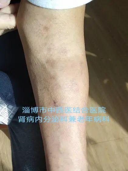 微信图片_20220915114909.jpg 微信图片_20220915114909.jpg